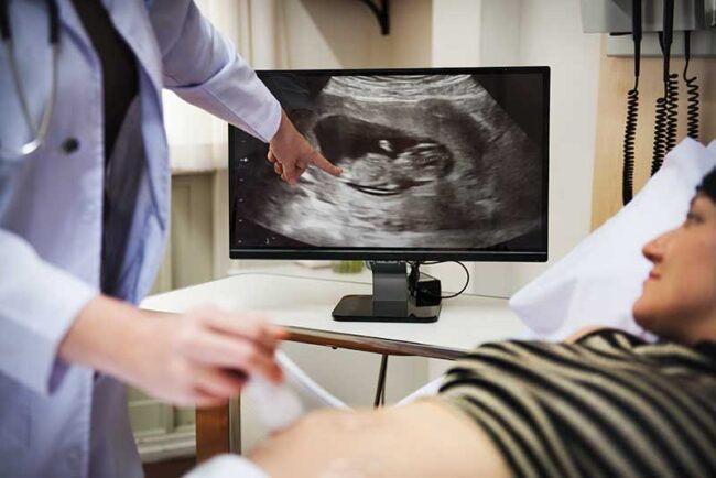 What-to-Expect-in-First-Trimester-Ultrasound What to Expect in First Trimester Ultrasound