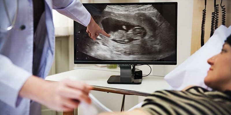 What-to-Expect-in-First-Trimester-Ultrasound What to Expect in First Trimester Ultrasound