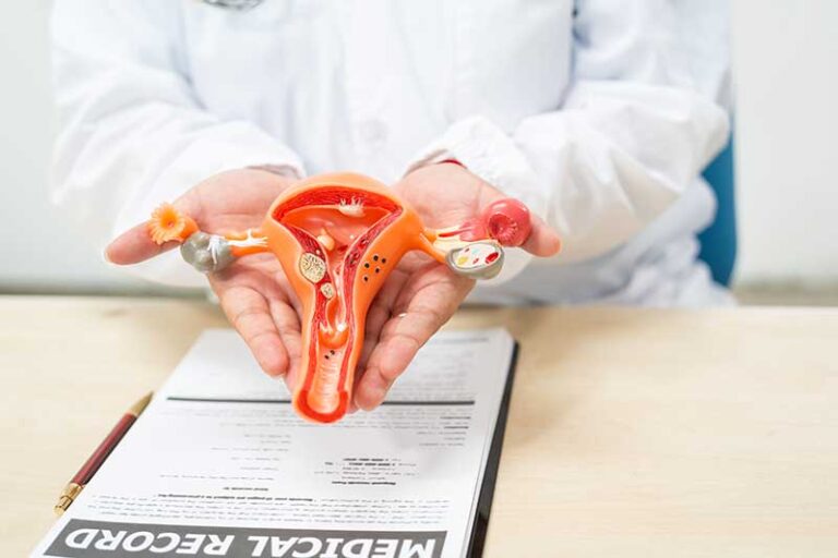 Uterine-Fibroids-Treatment-Guide Uterine Fibroids Treatment Guide