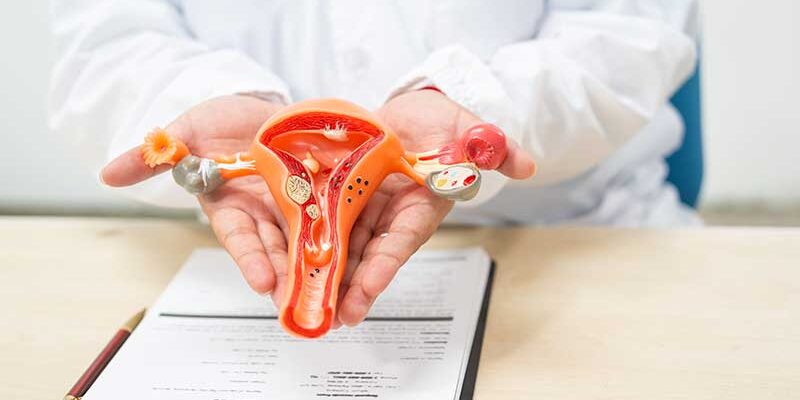 Uterine-Fibroids-Treatment-Guide Uterine Fibroids Treatment Guide